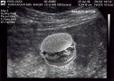 MyUltrasound.jpg