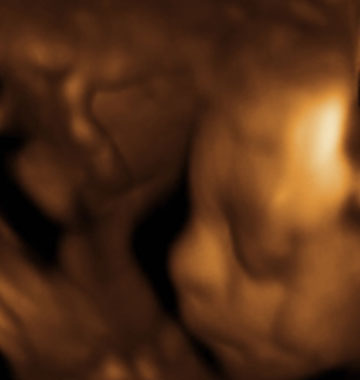 Baby #3's 3D Ultrasound 04