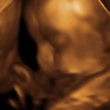 Baby #3's 3D Ultrasound 26