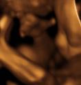 Baby #3's 3D Ultrasound 06