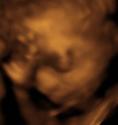 Baby #3's 3D Ultrasound 10