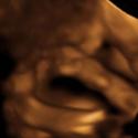 Baby #3's 3D Ultrasound 18