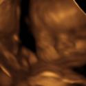Baby #3's 3D Ultrasound 29