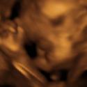 Baby #3's 3D Ultrasound 32
