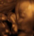 Baby #3's 3D Ultrasound 33