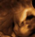 Baby #3's 3D Ultrasound 38